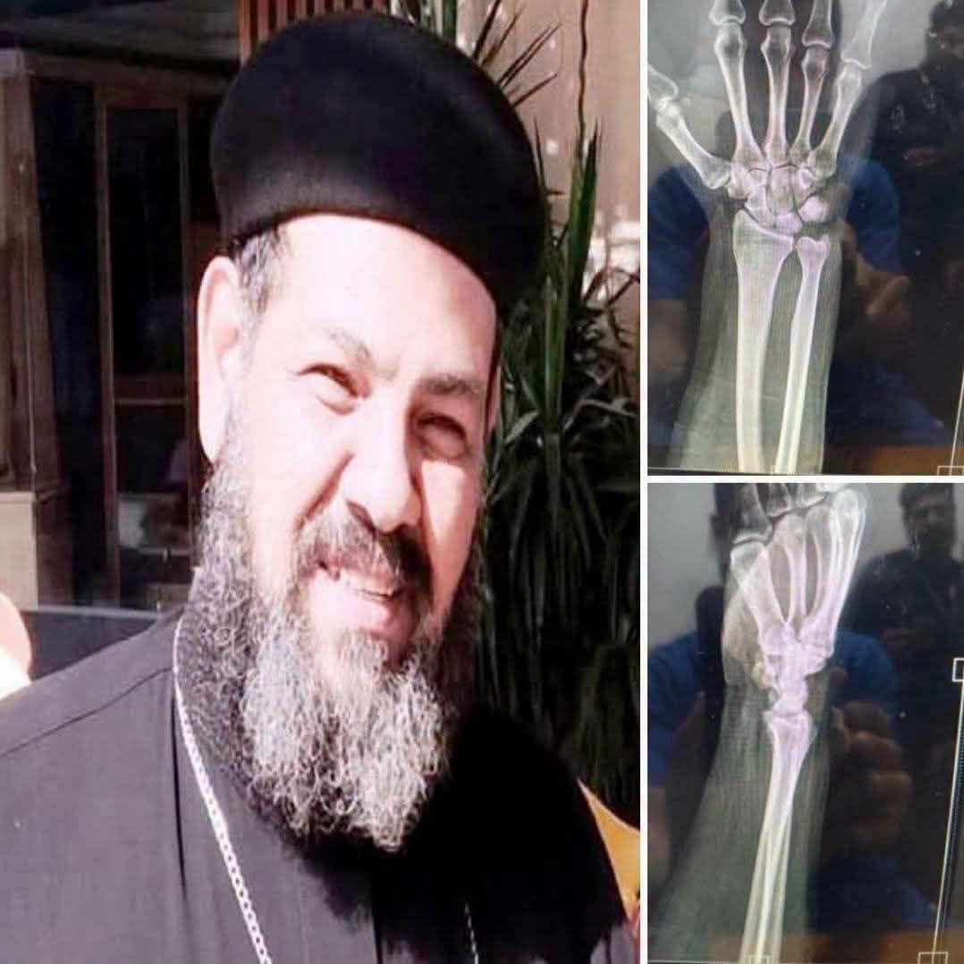 غموض يلف واقعة عين شمس.. هل يحسم تفريغ كاميرات المراقبة حقيقة الاعتداء على كاهن مدينة السلام؟ 1 واقعة كاهن عين شمس