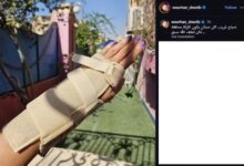 إصابة الفنانة نورهان