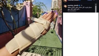 نورهان تنجو من "كارثة" مفاجئة وتكشف سر ابتعادها عن الشاشة 17 إصابة الفنانة نورهان