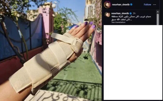 نورهان تنجو من "كارثة" مفاجئة وتكشف سر ابتعادها عن الشاشة 1 إصابة الفنانة نورهان